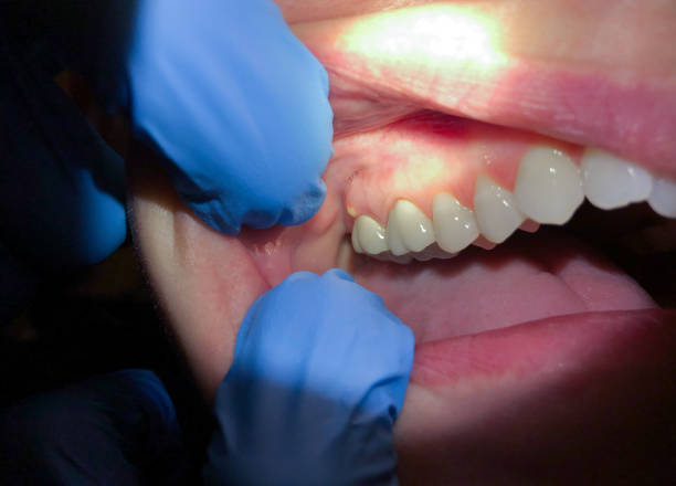 Best Emergency Dental Services for Seniors in Yacolt, WA