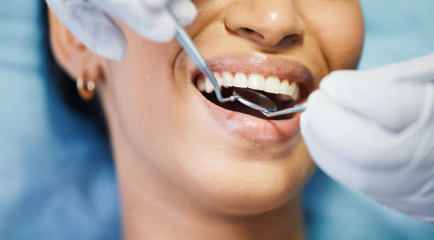 Best Emergency Dental Care for Abscessed Tooth in Yacolt, WA